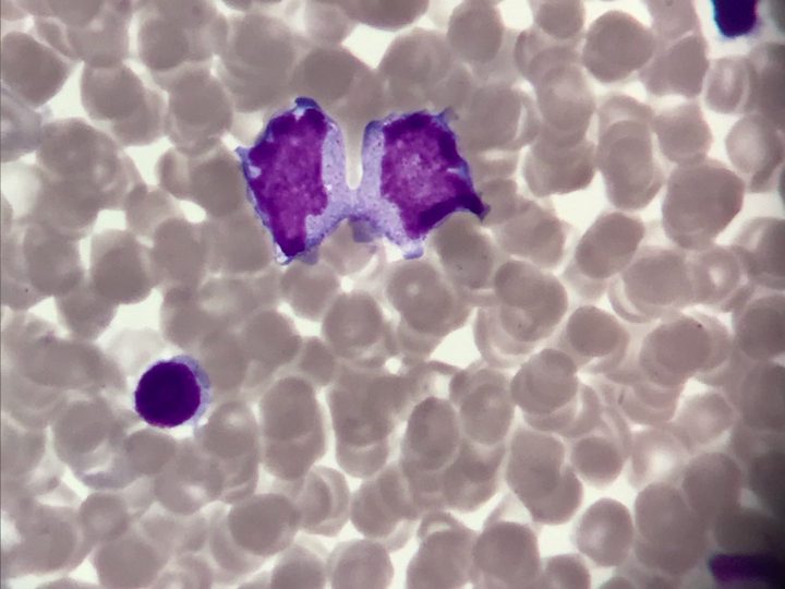 Bone marrow smear, overview microscopy of a field with a dividing cell