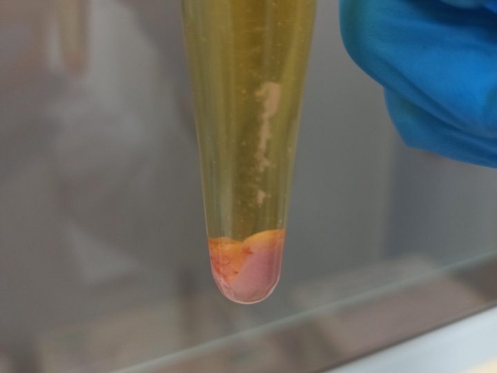 Urine tube: brick-pink sediment of salts after centrifugation