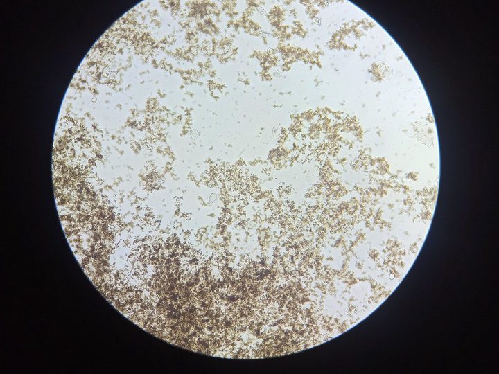 Native preparation of sediment: accumulations of salts and single epithelial cells