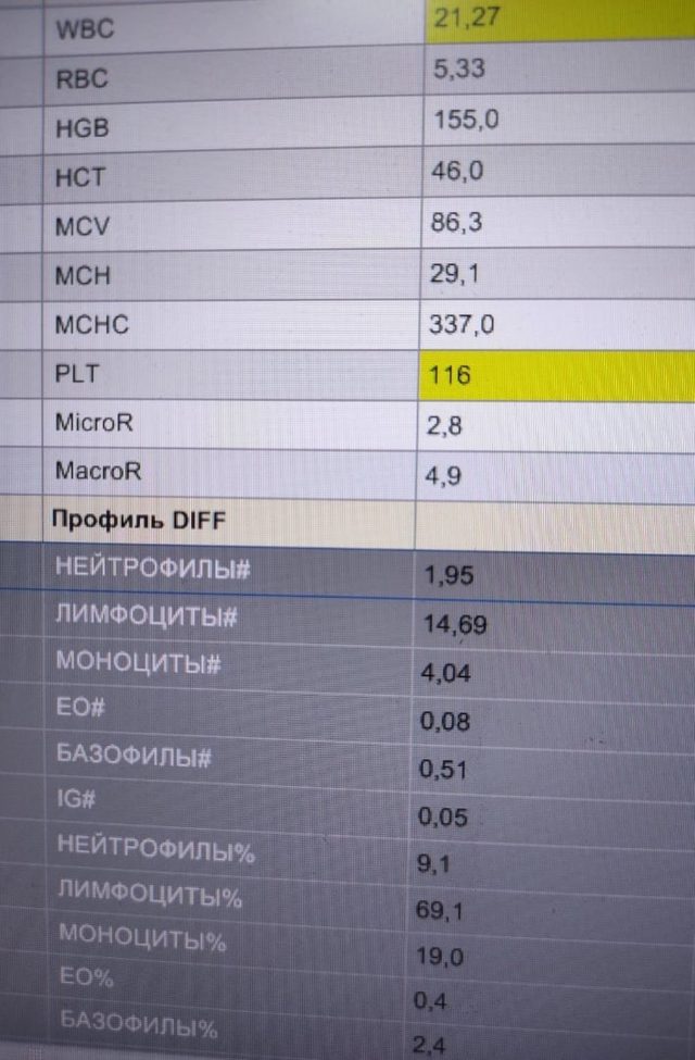 Атипичные мононуклеары при инфекционном мононуклеозе