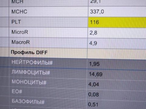 Распечатка анализатора: лейкоцитоз 21,27×10⁹/л и выраженный лимфоцитоз