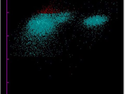 Скаттерограмма WPC анализатора Sysmex для дифференциации реактивных клеток и бластов