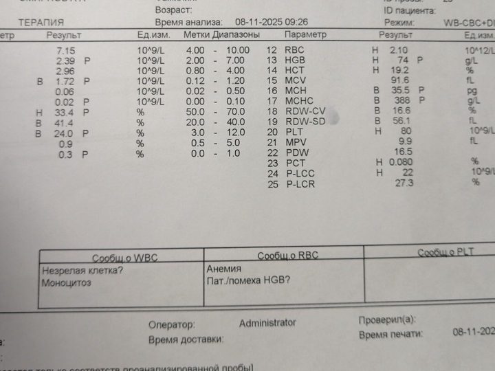 Analyzer printout: anemia with HGB 74 g/L and thrombocytopenia PLT 80