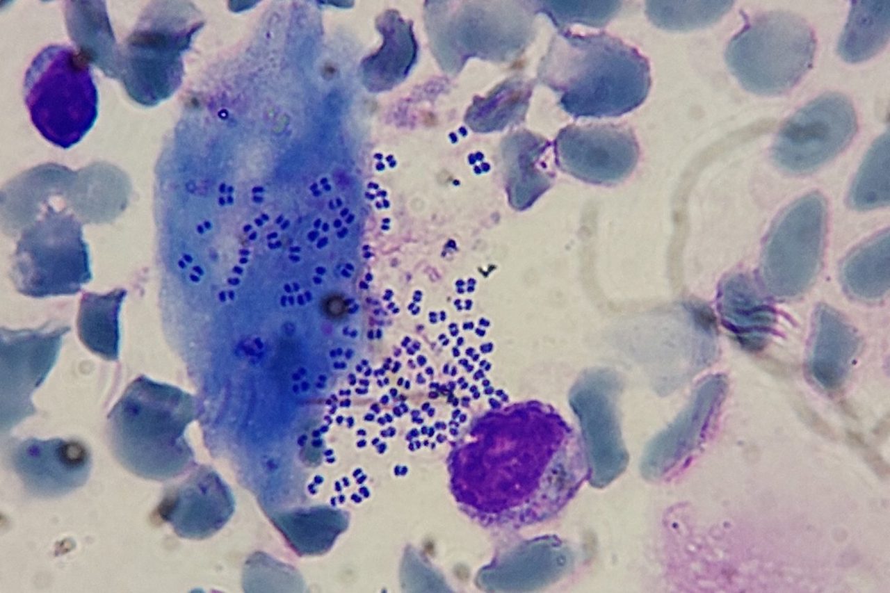 Bacteria and Fungi in Blood Smears: Sepsis or Artifact?
