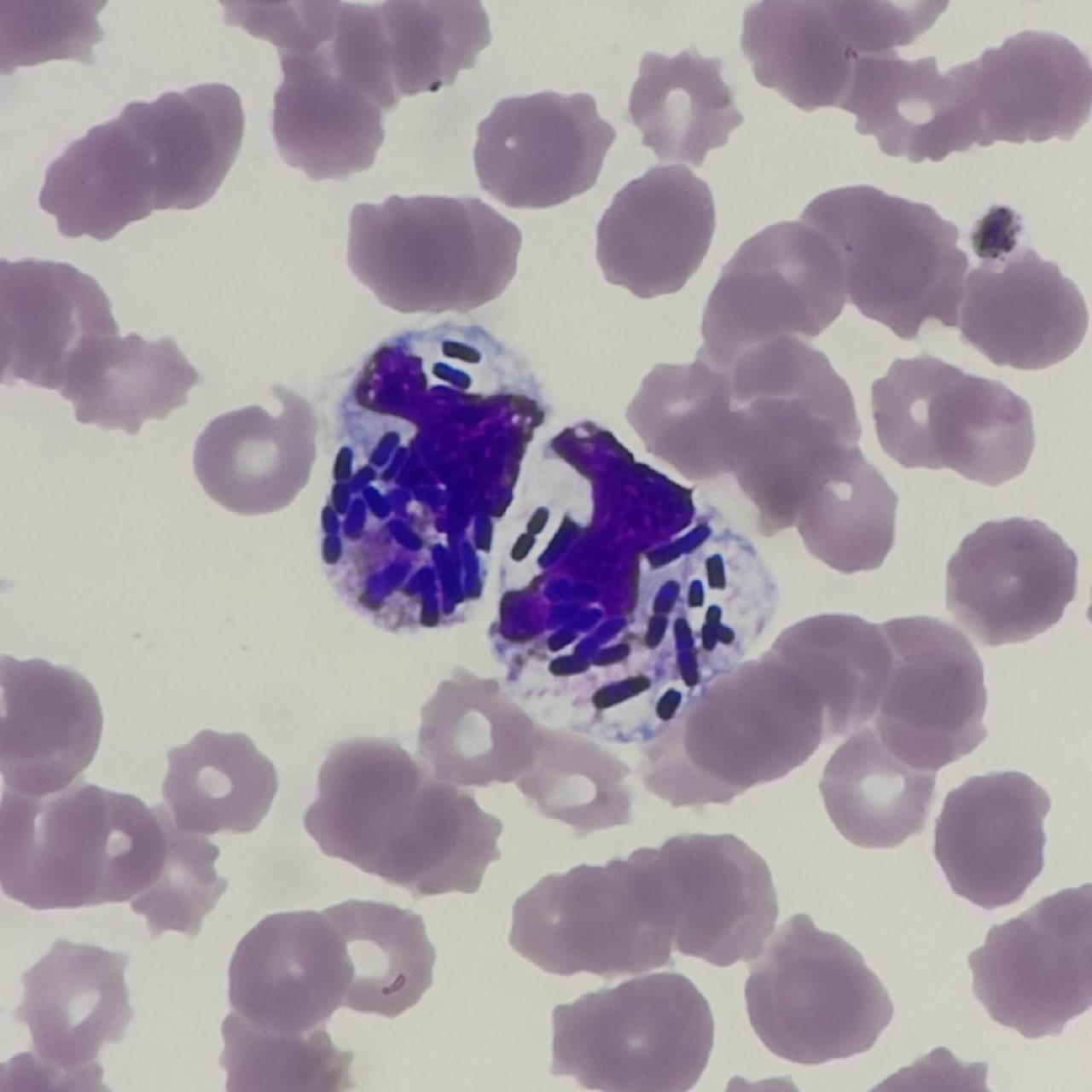 Бактерии в мазке крови при сепсисе: Klebsiella pneumoniae