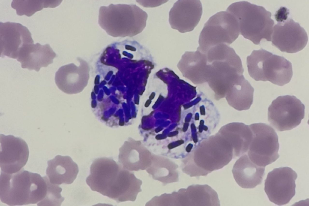 Бактерии в мазке крови при сепсисе: Klebsiella pneumoniae