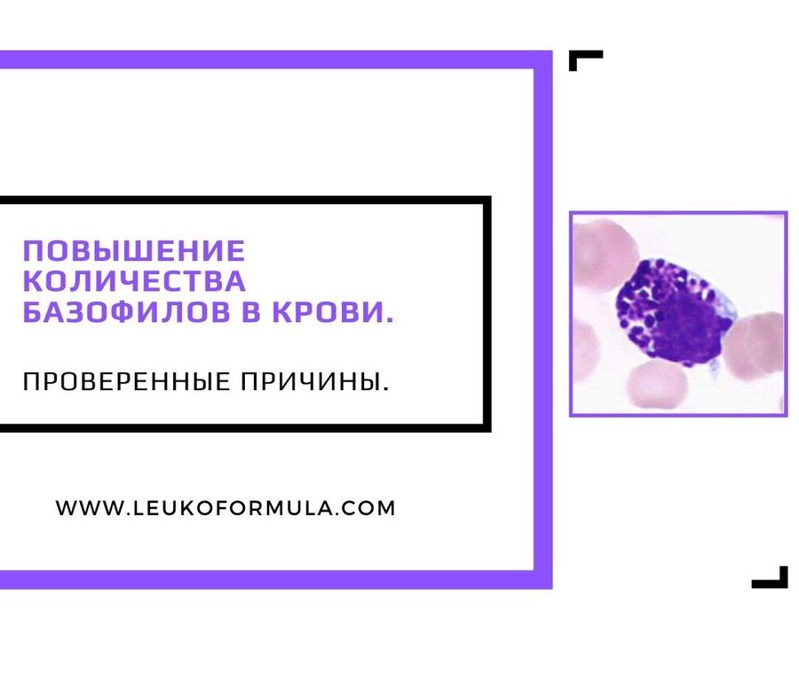 Базофилы повышены: причины, норма и когда искать ХМЛ
