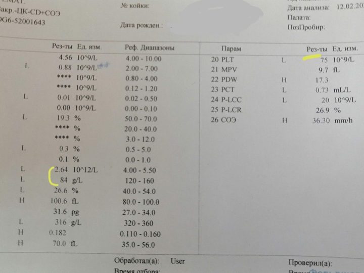 Распечатка гематологического анализатора: цитопения (HGB 84 г/л, PLT 75×10⁹/л)