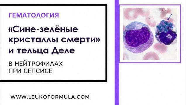 «Blue-green crystals of death» and Döhle bodies in neutrophils