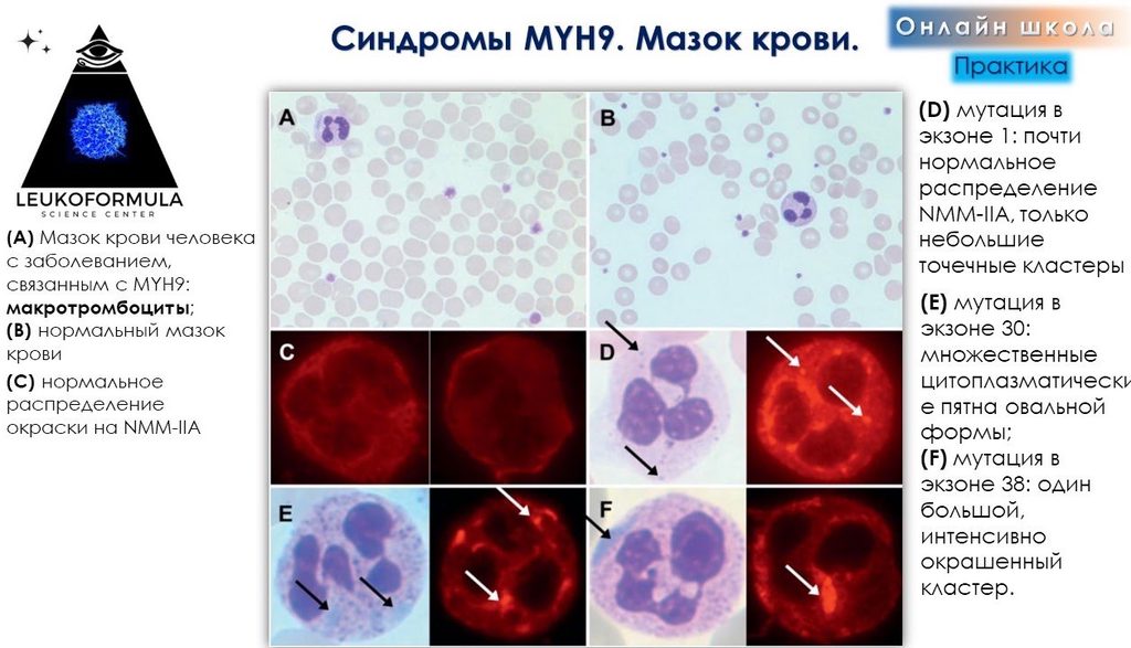 A slide from the lesson «Platelet morphology»