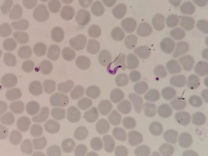 Blood smear: Trypanosoma cruzi trypomastigote with characteristic kinetoplast