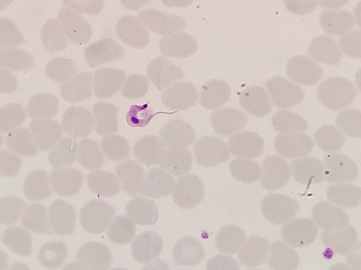 Blood smear: C-shaped form of the Chagas disease pathogen trypomastigote
