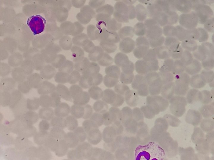 Blood smear: trypanosome surrounded by leukocytes and erythrocytes