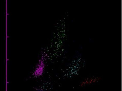 Скатерограмма WDF анализатора Sysmex со шлейфом в области моноцитов