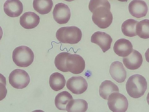 Мазок крови: спирохета Borrelia между эритроцитами при большом увеличении