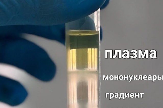 Центрифугирование периферической крови в двойном градиенте плотности