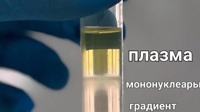Центрифугирование периферической крови в двойном градиенте плотности