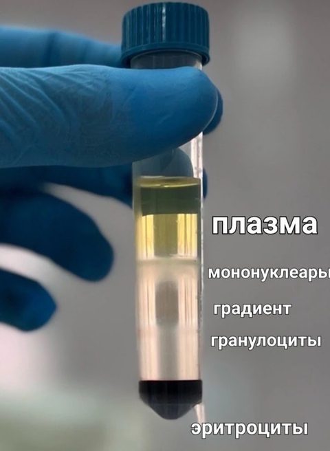 Разделение крови на фракции после центрифугирования