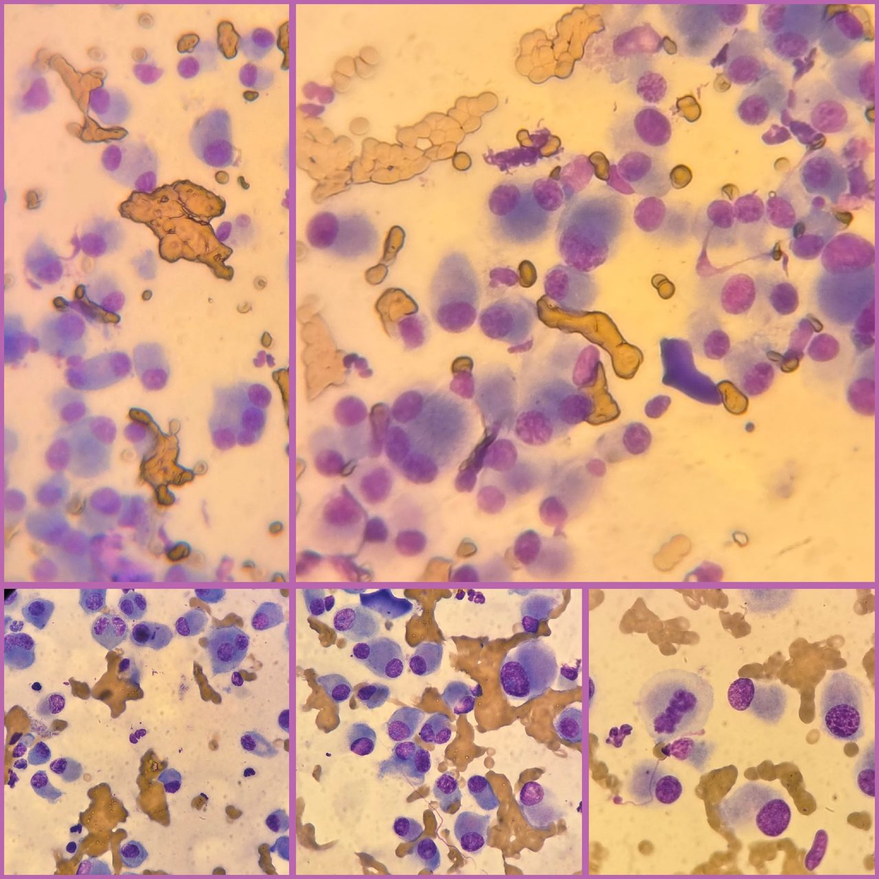Feline Cutaneous Plasmacytoma Cytology: Impression Smear