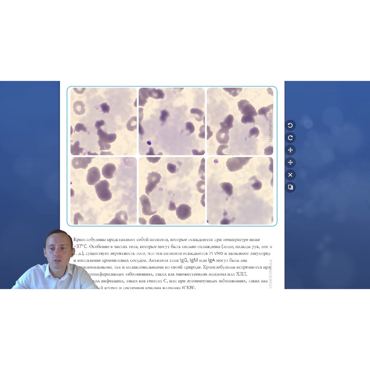 Blood and Bone Marrow Cytomorphology: Case Studies