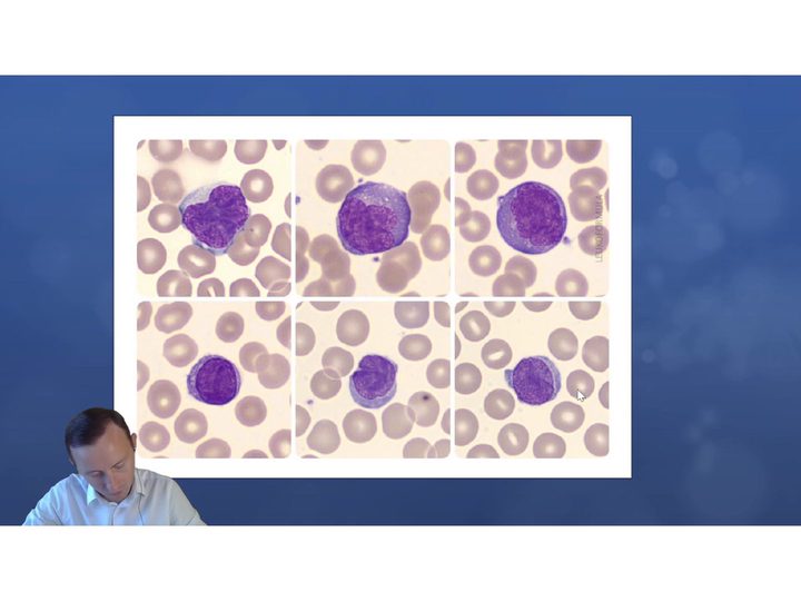 Presentation slide with six photomicrographs of blood lymphocytes