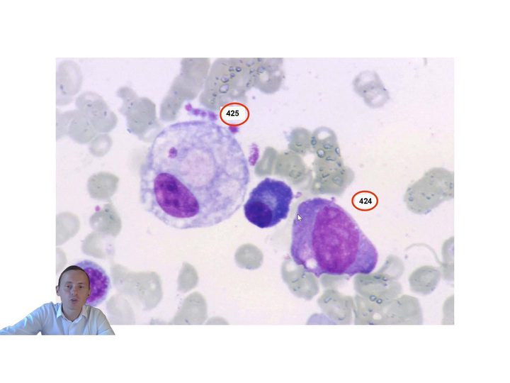 Bone marrow smear with numbered hematopoietic cells for identification