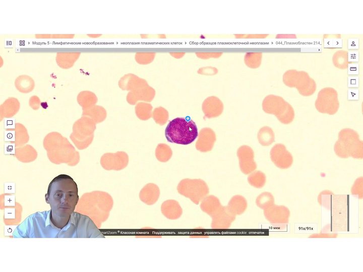 Digital blood smear in SmartZoom software with a plasmablast in the center of the field