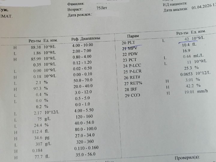 Бланк ОАК: лейкоцитоз (WBC 88,38), лимфоцитоз (Lym 97,3%), анемия и тромбоцитопения