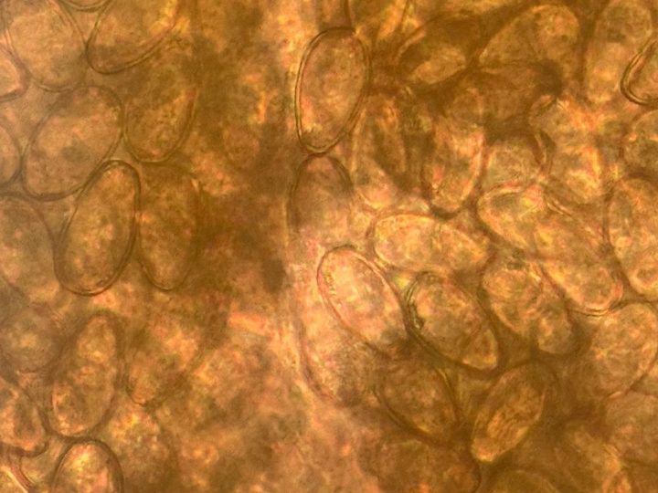 Microscopy of a native preparation: Opisthorchis felineus eggs under high magnification