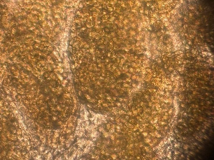 Microscopy of a fluke body: the helminth's uterus, densely filled with opisthorch eggs