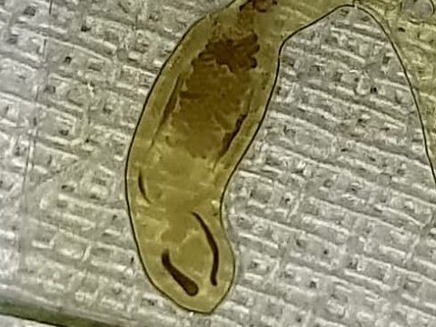 Fragment of a microscope slide: opisthorchis marita close-up with anatomical details