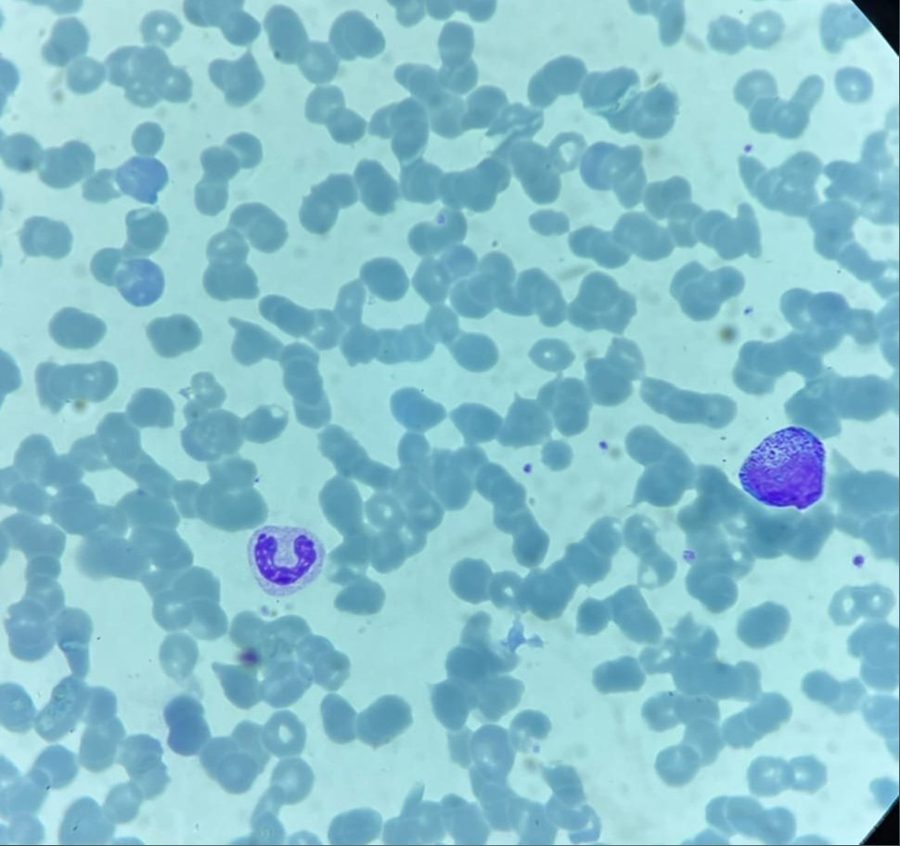 Differential Diagnosis of Granulated Cells in Blood Smears