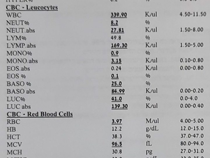 Распечатка гематологического анализатора: лейкоциты 339,9 K/ul