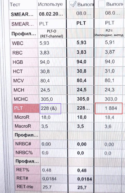 Анализ на анализаторе Sysmex серии XN: каналы RET и импедансный