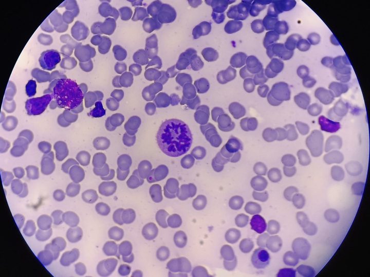 Bone marrow smear: dividing cell at metaphase stage