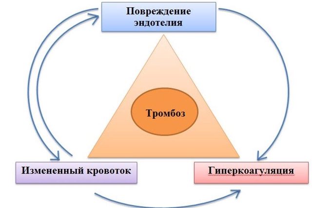 Тромбоз «геймера»: чем опасны долгие часы за компьютером