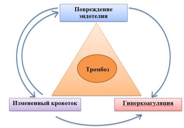 Тромбоз «геймера»: чем опасны долгие часы за компьютером