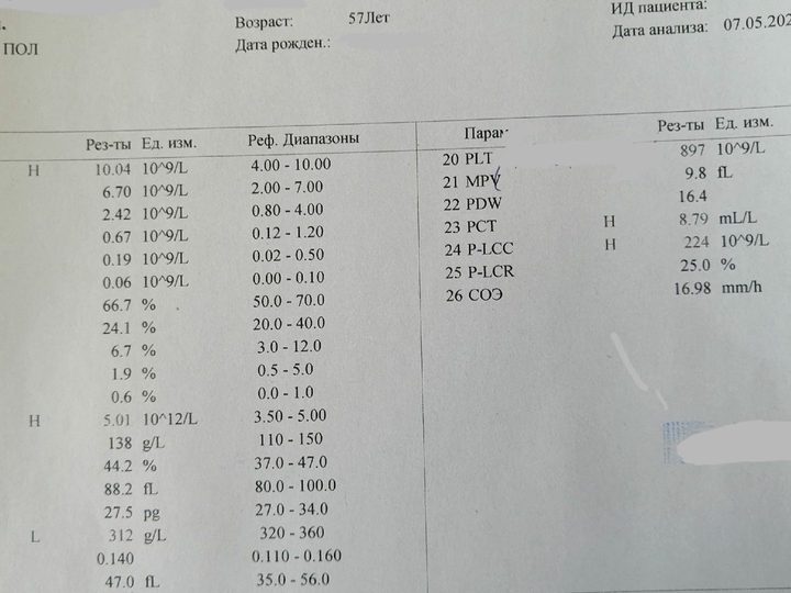 Analyzer printout: platelet count 897×10^9/L and leukocyte count 10.04×10^9/L