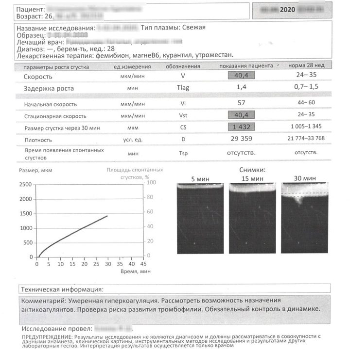 Бланк тромбодинамики с признаками умеренной гиперкоагуляции (Vst 40,4 мкм/мин)