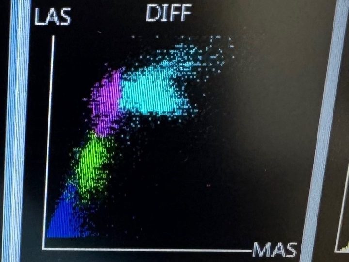 Analyzer scattergram: pathological light scattering on the DIFF graph