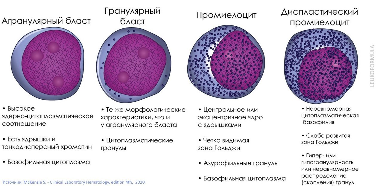 Схема морфологических отличий гранулярных бластов и промиелоцитов