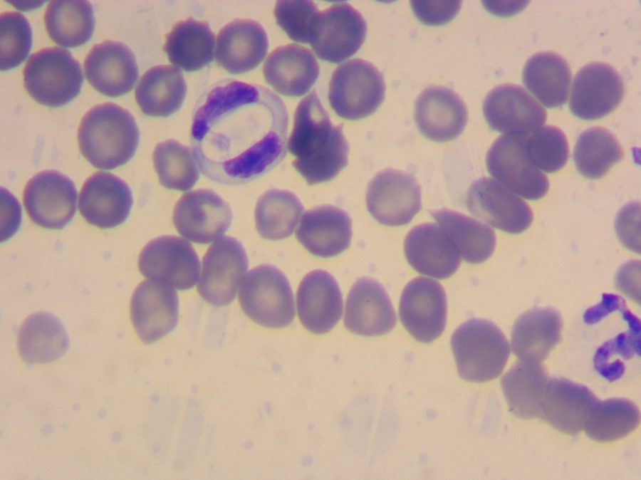 Hepatozoon canis in Blood Smear: Gamont Detection