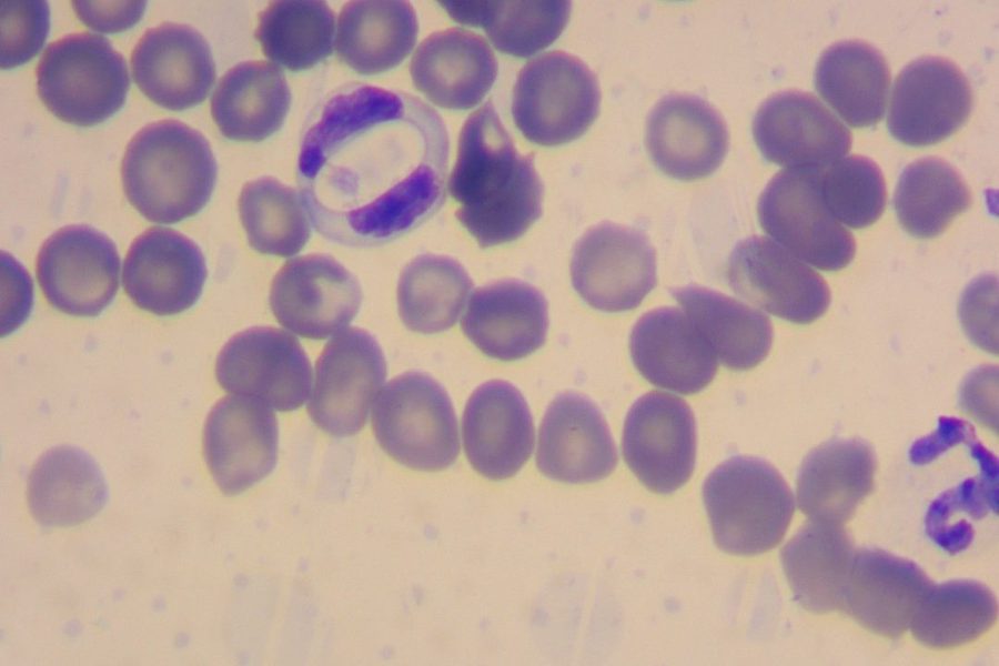 Hepatozoon canis в мазке крови: выявление гамонтов