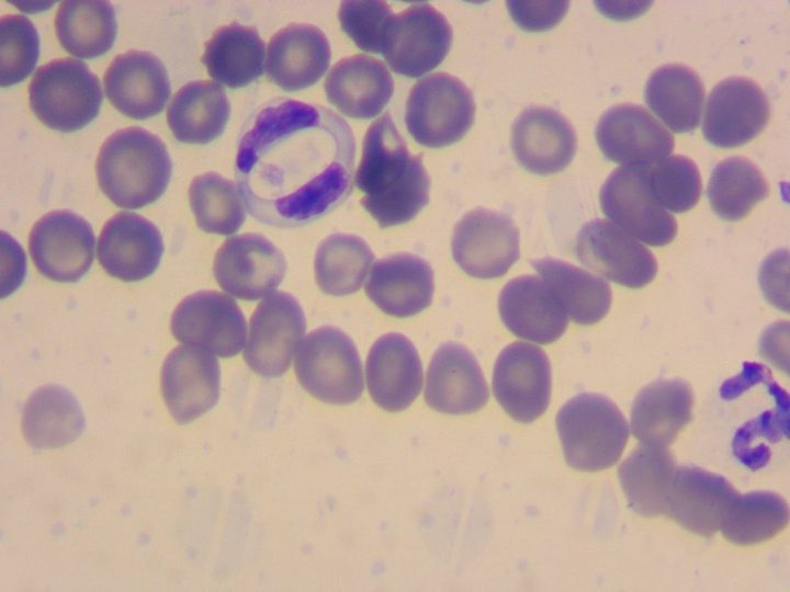 Мазок крови, гамонт Hepatozoon canis в цитоплазме сегментоядерного нейтрофила