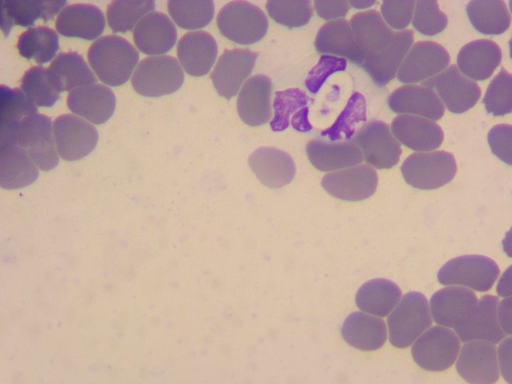Мазок крови, внутриклеточный паразит Hepatozoon canis в лейкоците