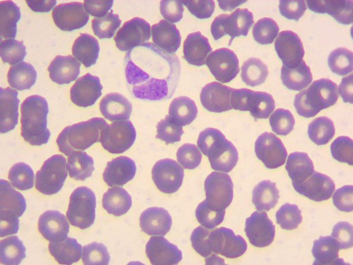 Мазок крови, крупный гамонт Hepatozoon canis, деформирующий ядро нейтрофила