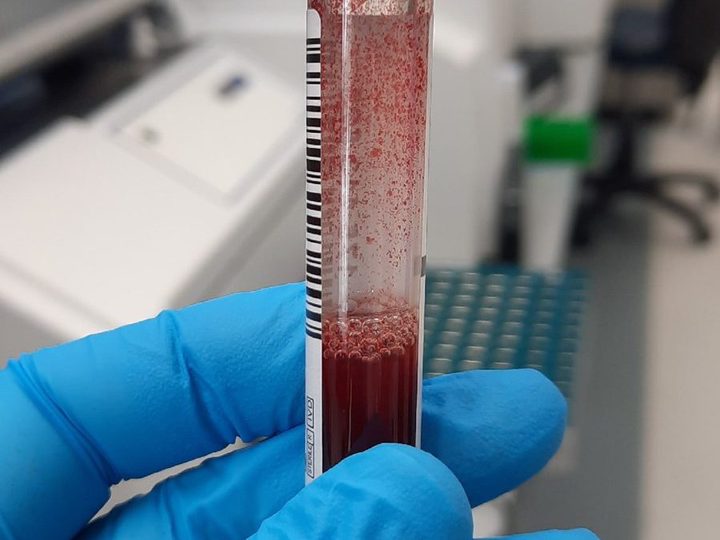 Blood tube: pronounced erythrocyte agglutination on the walls