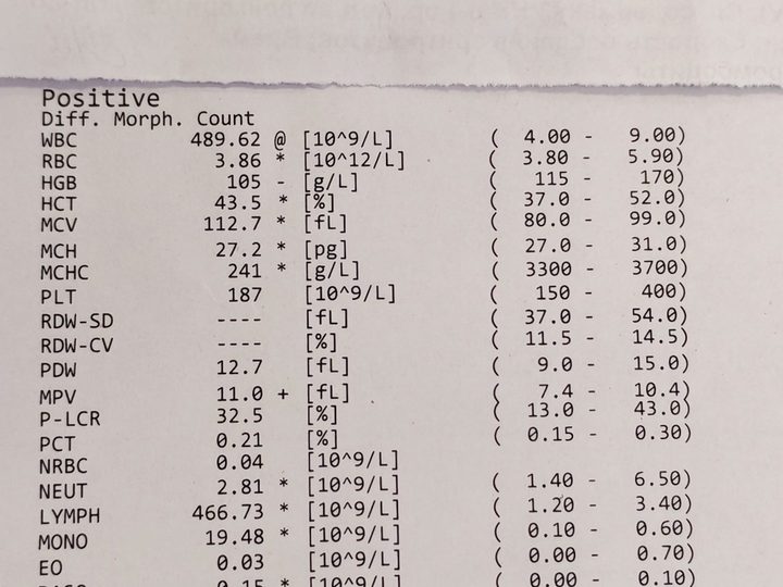 Analyser printout: WBC 489.6×10⁹/L, lymphocytes 466.7×10⁹/L