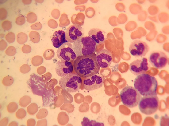 Bone marrow smear: mitotic figure surrounded by maturing granulocytes