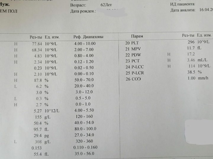Analyzer printout: leukocytosis WBC 77.84×10⁹/L and absolute basophilia